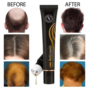 Çıkma Organik Saç Serumu Rulo Seti Biotin Saç Büyüme Serumu Üçlü Roll-On Masaj Saç Büyüme Özü Tüm Saç Tipleri için